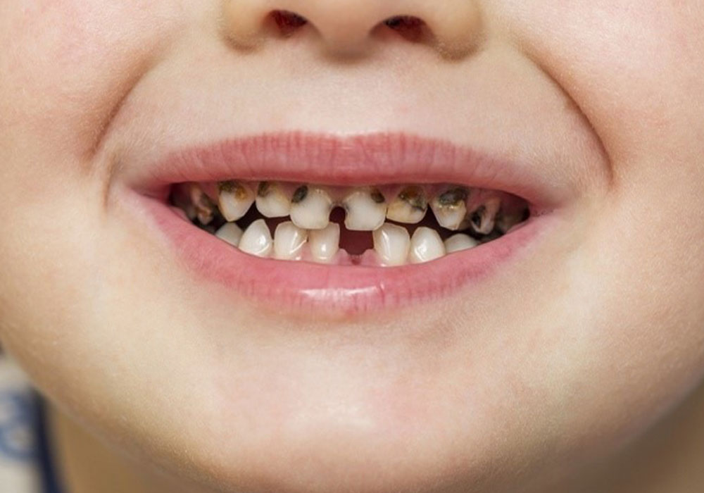 Smile Issue The Tooth Bay
